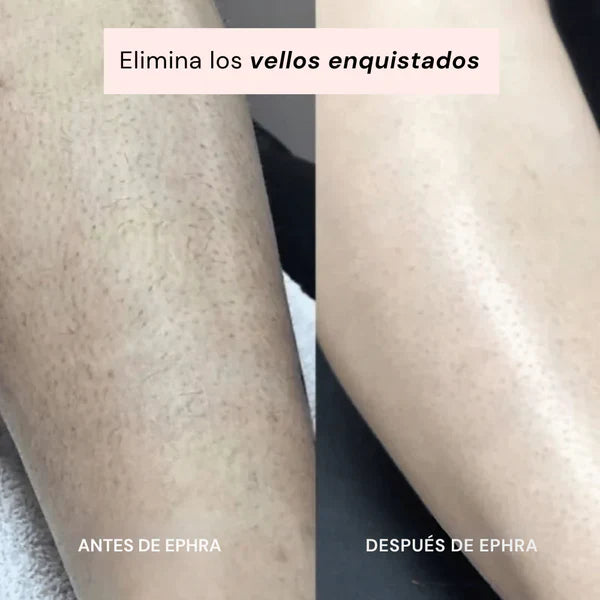 EPHRA - Depiladora Íntima 2 en 1