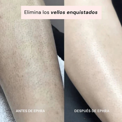 EPHRA - Depiladora Íntima 2 en 1